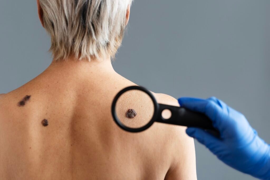 Dermatólogo examinando piel con dermatoscopio digital en Centro Clínico 2000 Getafe Sector 3